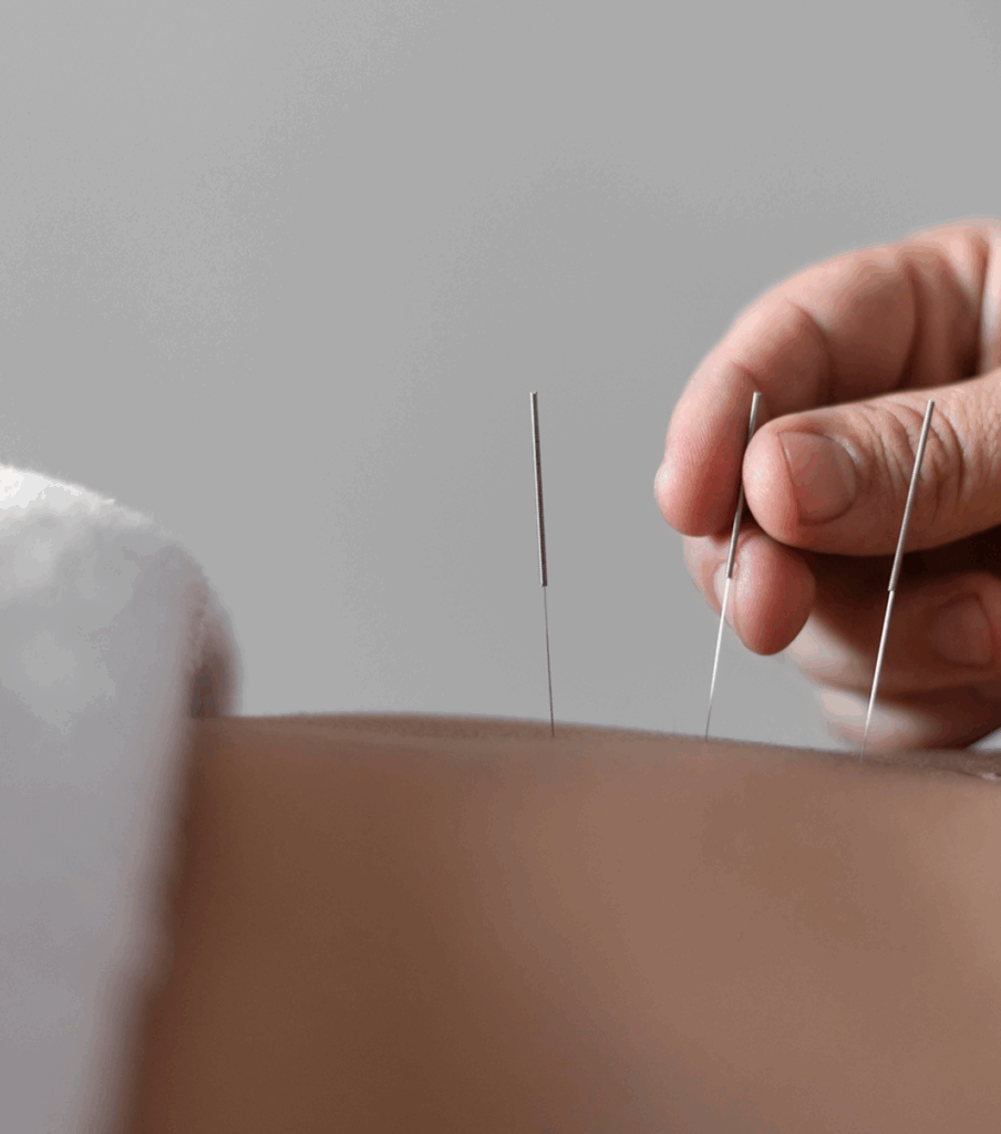 Akupunktursprechstunde