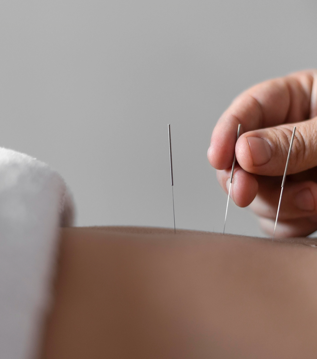 Akupunktursprechstunde